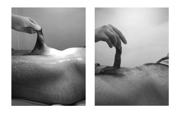 penis-embutido-02